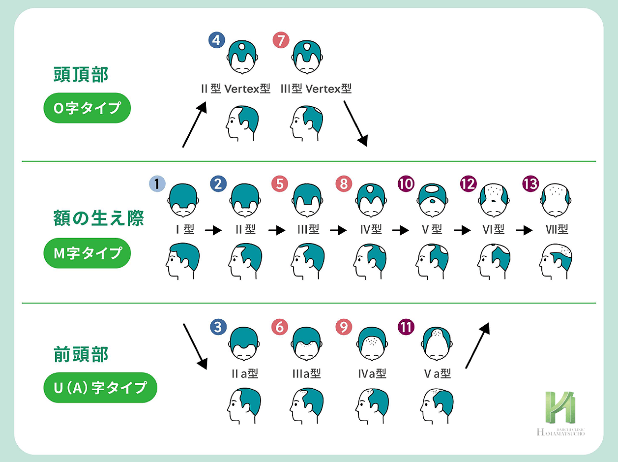 ハミルトン・ノーウッド分類のインフォグラフ