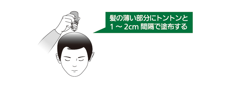 ミノアップ使用解説4