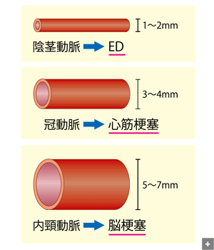 二次性不眠症のva障害評価