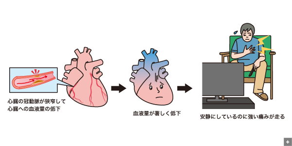 勃起不全の消耗