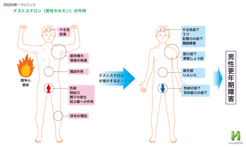 うつ病とed Edとは 浜松町第一クリニック うつ病とed Edとは 浜松町第一クリニック