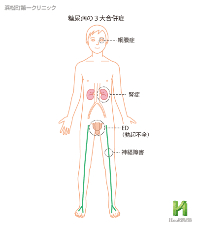 勃起不全を治療するための方法