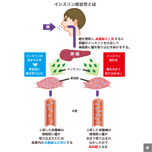 勃起不全の泌尿器科