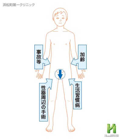 器質性EDの原因