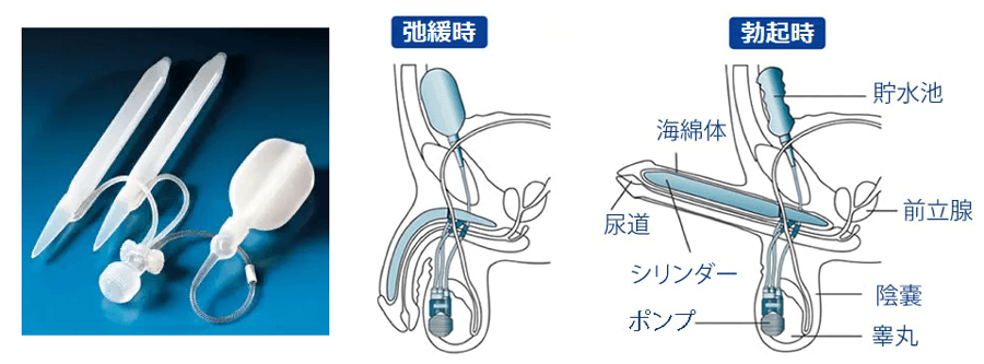 ビタミンDレベルが低いと勃起不全を引き起こす可能性があります