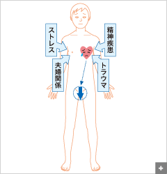 心因性EDの原因