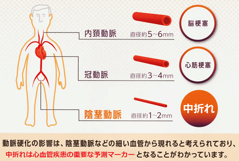 何歳から立たなくなる？