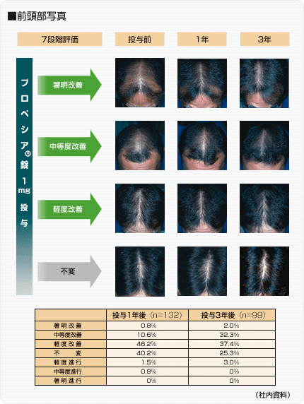 改善効果:前頭部写真