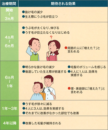 プロペシアによる治療期間と期待される効果の推移