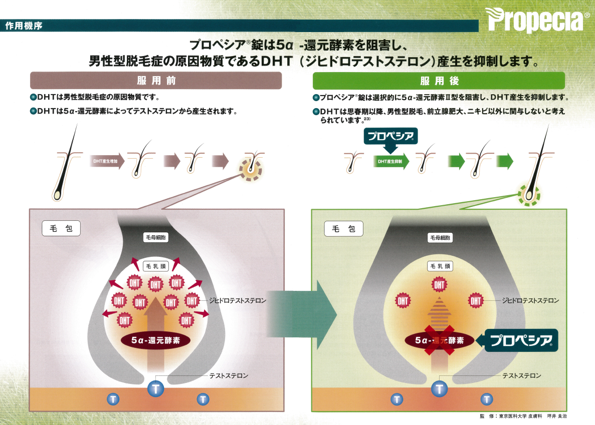 プロペシアの作用機序図解