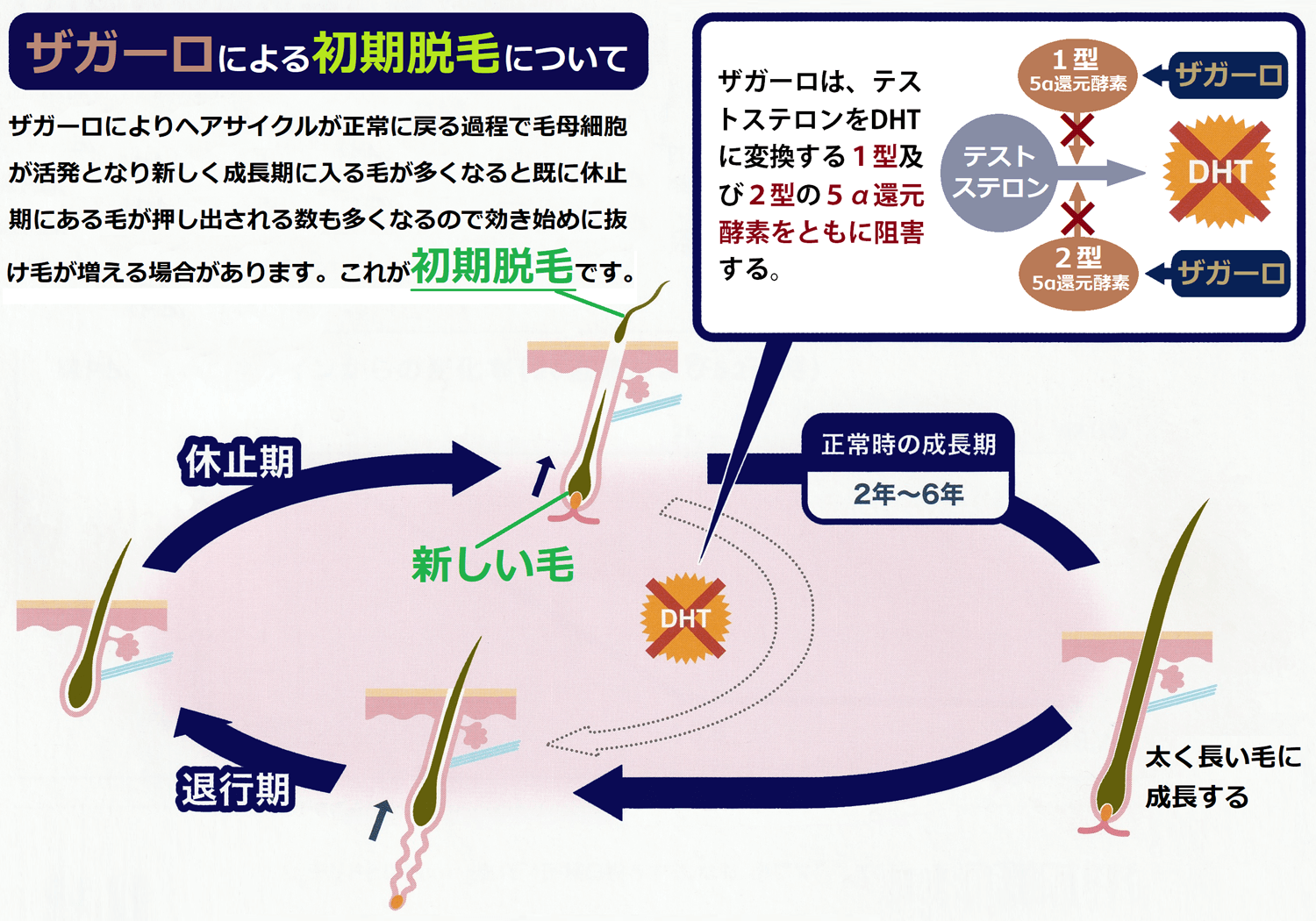 ザガーロによる初期脱毛について